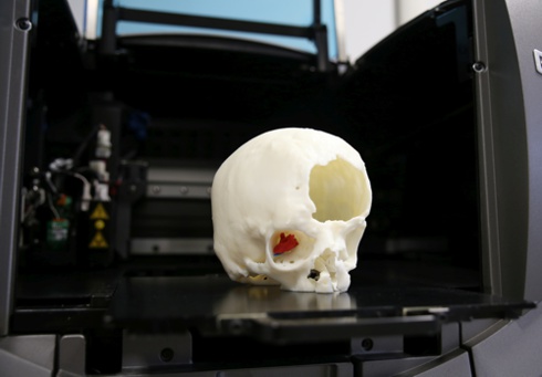 Fotografia del crainio stampato con la tecnologia 3d